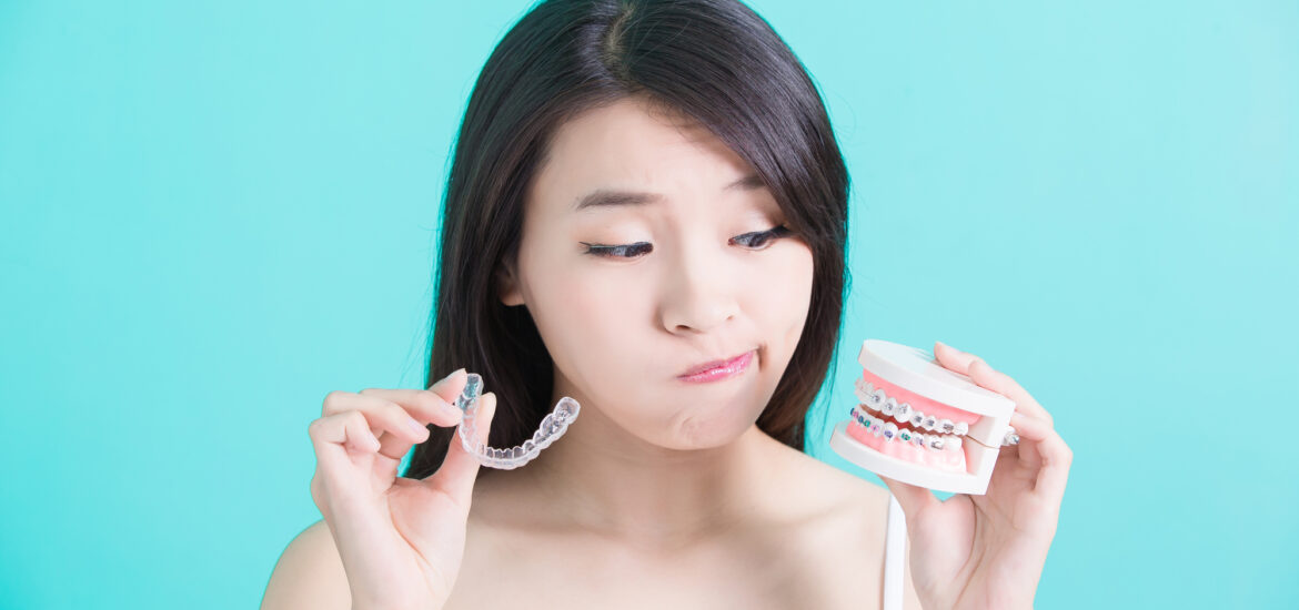 Benefits-of-Invisalign