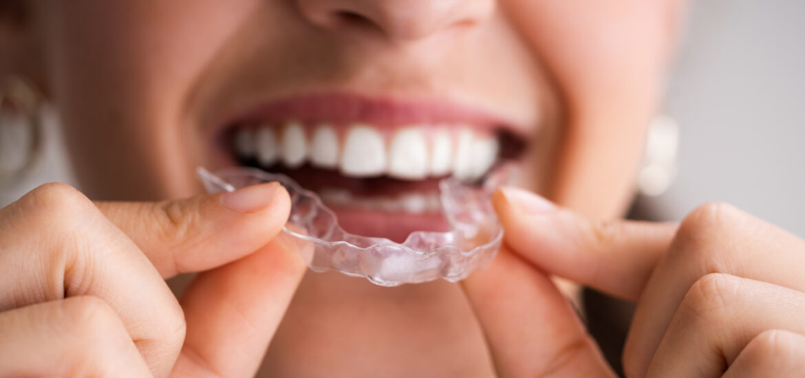 dental night guard for teeth