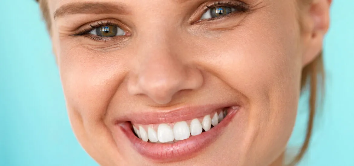 Teeth Whitening Magna