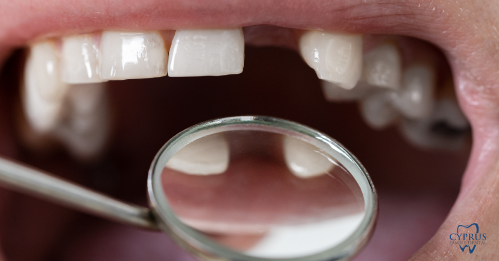 restorative-dentistry-magna-utah