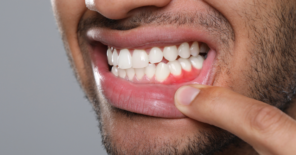 emergency-dentist-magna-utah