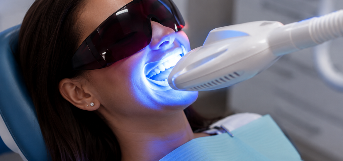 Professional teeth whitening, Magna