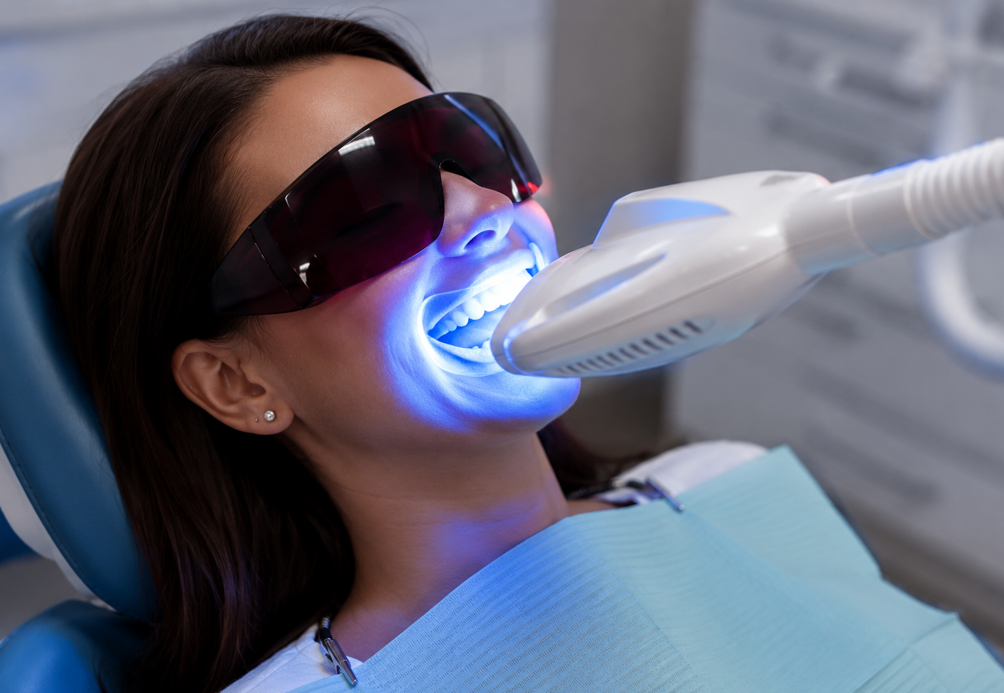 Professional teeth whitening, Magna
